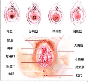 韩式处女膜修补术，半小时还你无瑕女儿身